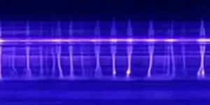 Plasma ozone