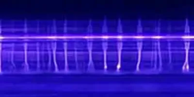 Plasma ozone